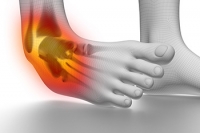 Symptoms and Causes of Ankle Sprains